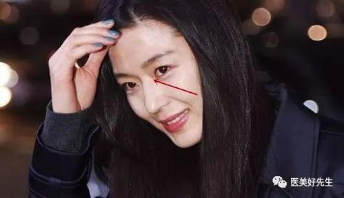 哪些明星隆过鼻,那些曾动过鼻子的明星